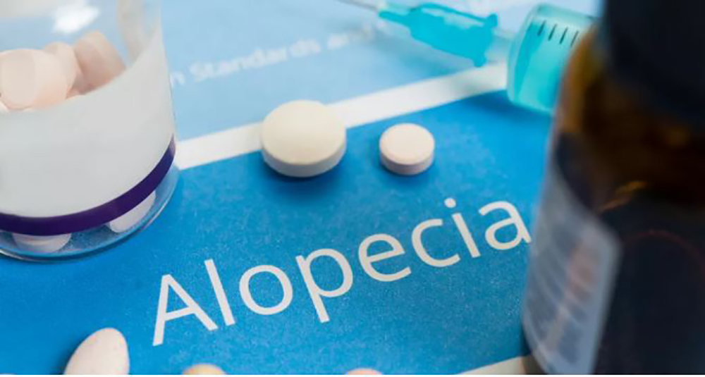 alopecia, salud, pastilla, red latina, 